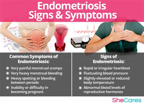 sign and symptoms of endometriosis